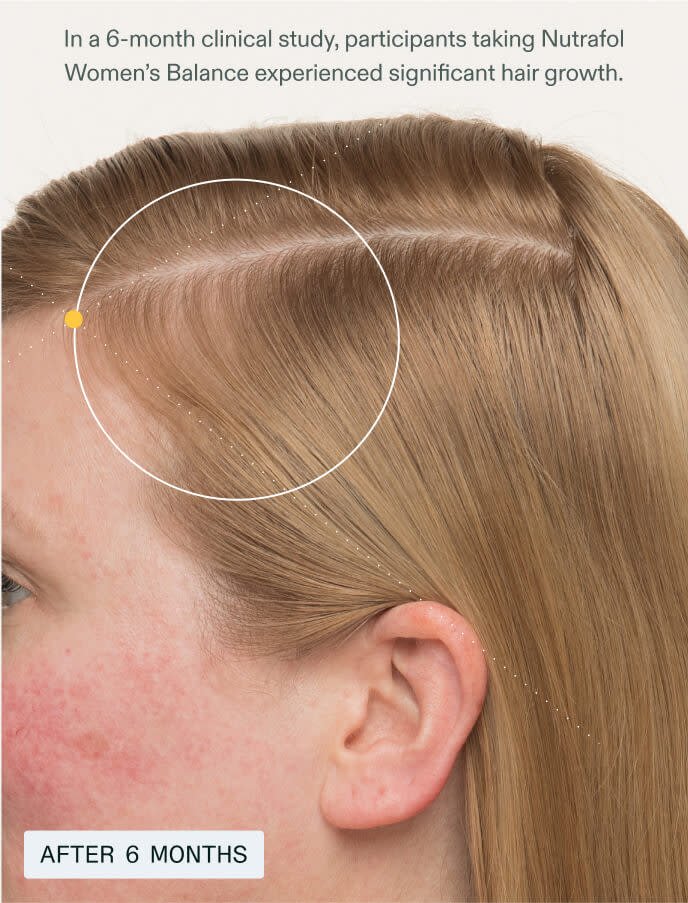 After 6 months - participants experienced significant hair growth compared to placebo.